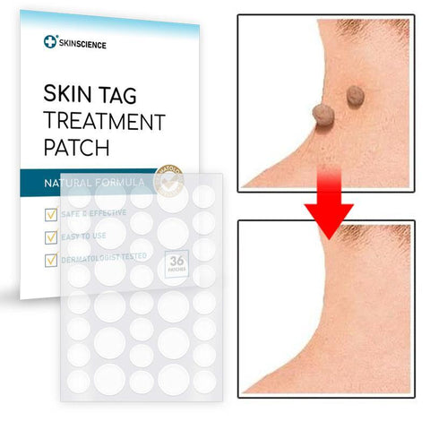 Skin Tag Spot Treatment Patch